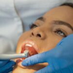 Détartrage et aphtes : à quelle fréquence faut-il le faire ?